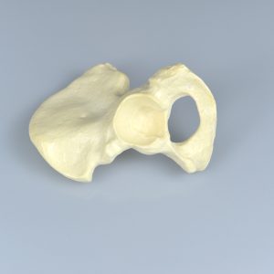 1/3 pelvis